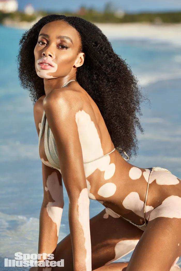 Winnie Harlow